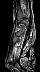 Wrist2.gif