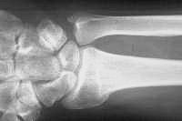 Click for larger image