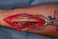 Click for larger image