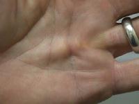 Click for larger image