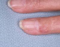 Click for larger image