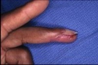 Click to enlarge Highslide