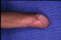 Click to enlarge Highslide