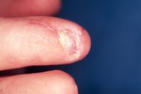 Click to enlarge Highslide