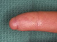 Click to enlarge Highslide